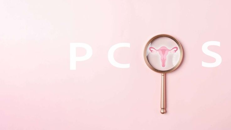 Understanding PCOS and Its Impact on Fertility